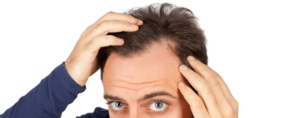 مکمل ضد ریزش ارثی سائوپالمتو | Sawpalmetto Afterave